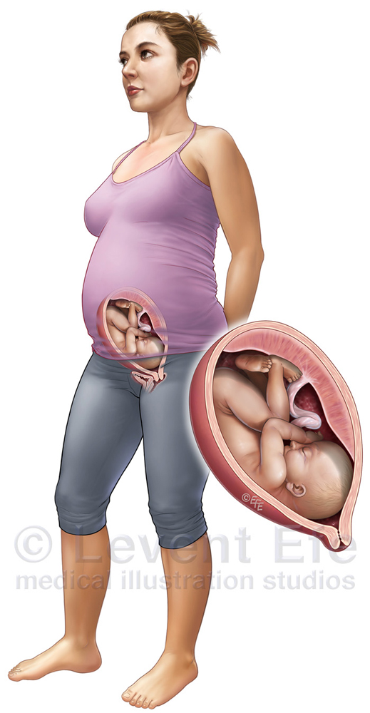 30-weeks pregnant woman